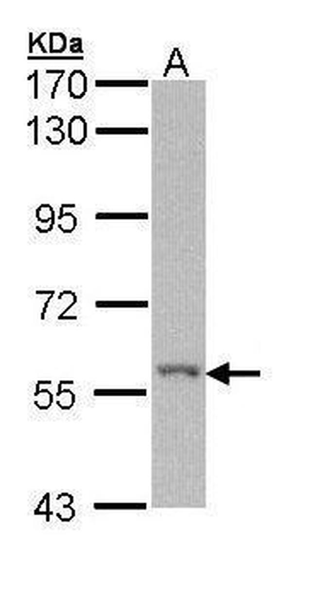 RIP2 Antibody in Western Blot (WB)