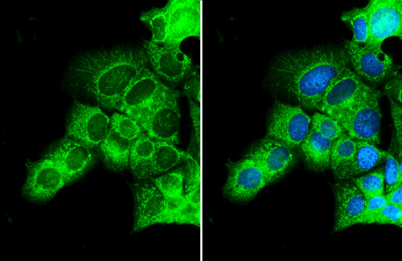 TBK1 Antibody in Immunocytochemistry (ICC/IF)