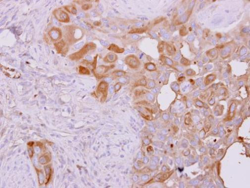 TBK1 Antibody in Immunohistochemistry (Paraffin) (IHC (P))