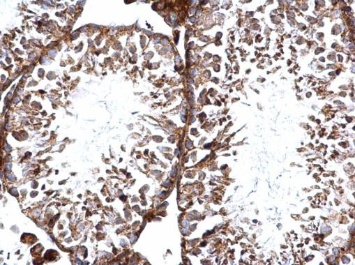 TBK1 Antibody in Immunohistochemistry (Paraffin) (IHC (P))