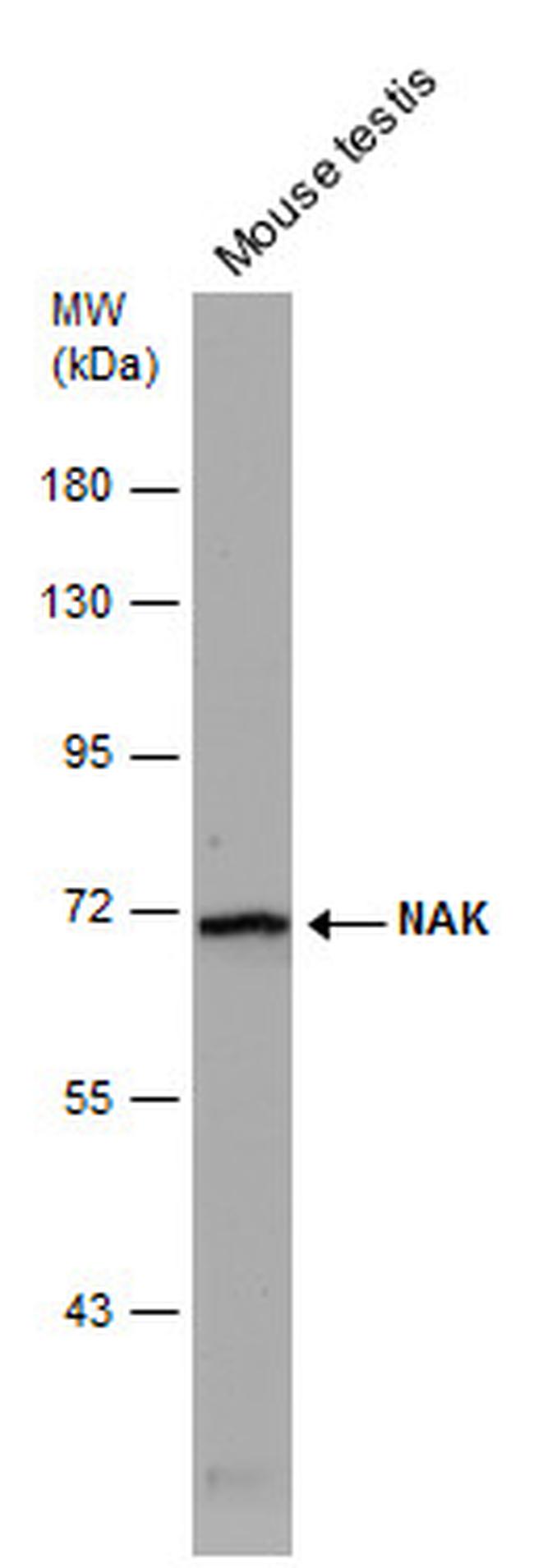 TBK1 Antibody in Western Blot (WB)