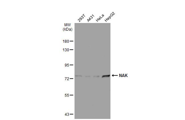 TBK1 Antibody in Western Blot (WB)