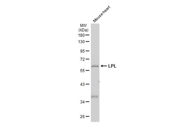 LPL Antibody in Western Blot (WB)