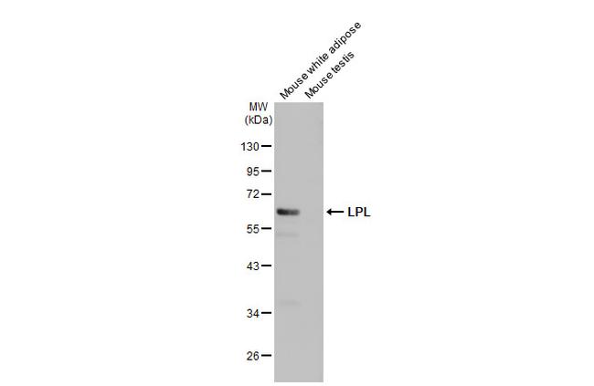 LPL Antibody in Western Blot (WB)