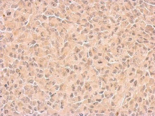 COX1 Antibody in Immunohistochemistry (Paraffin) (IHC (P))