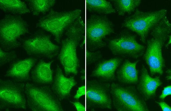 STAT6 Antibody in Immunocytochemistry (ICC/IF)