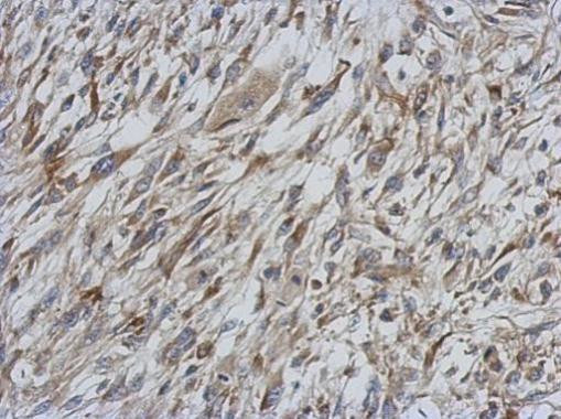 STAT6 Antibody in Immunohistochemistry (Paraffin) (IHC (P))