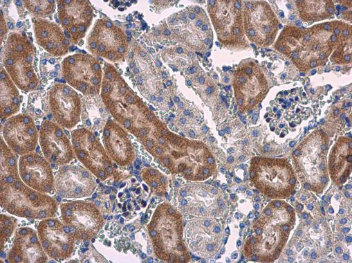 STAT6 Antibody in Immunohistochemistry (Paraffin) (IHC (P))