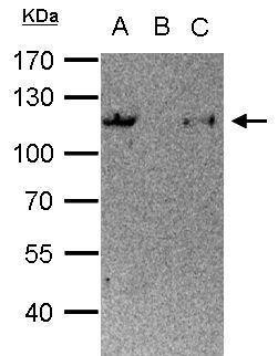 STAT6 Antibody in Immunoprecipitation (IP)