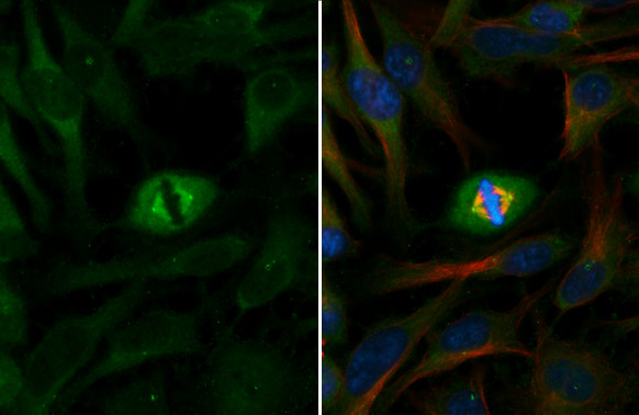 gamma Tubulin Antibody in Immunocytochemistry (ICC/IF)