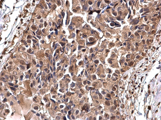 gamma Tubulin Antibody in Immunohistochemistry (Paraffin) (IHC (P))