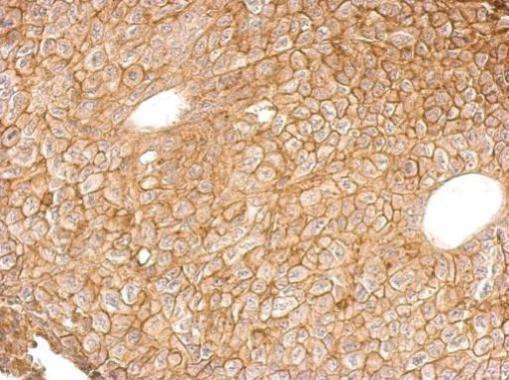 Annexin A4 Antibody in Immunohistochemistry (Paraffin) (IHC (P))