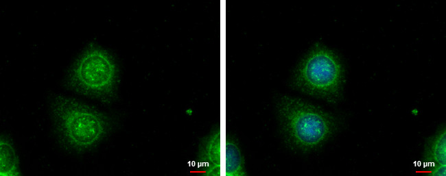 Galectin 3 Antibody in Immunocytochemistry (ICC/IF)