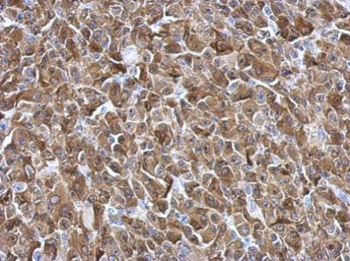 Galectin 3 Antibody in Immunohistochemistry (Paraffin) (IHC (P))