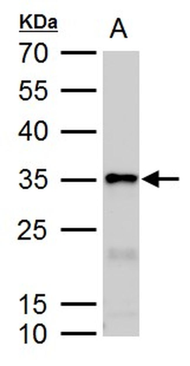 Galectin 3 Antibody in Western Blot (WB)