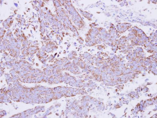 15-PGDH Antibody in Immunohistochemistry (Paraffin) (IHC (P))