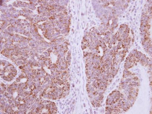 DcR3 Antibody in Immunohistochemistry (Paraffin) (IHC (P))