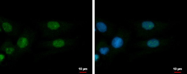 ADARB1 Antibody in Immunocytochemistry (ICC/IF)