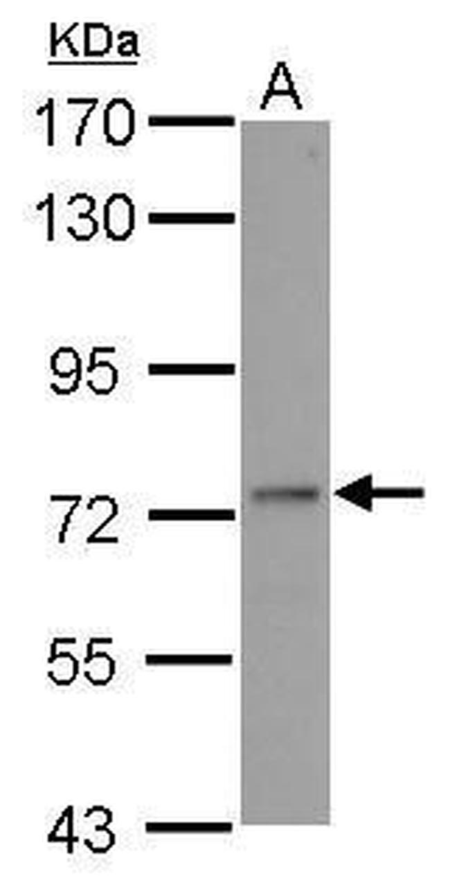 ADARB1 Antibody in Western Blot (WB)