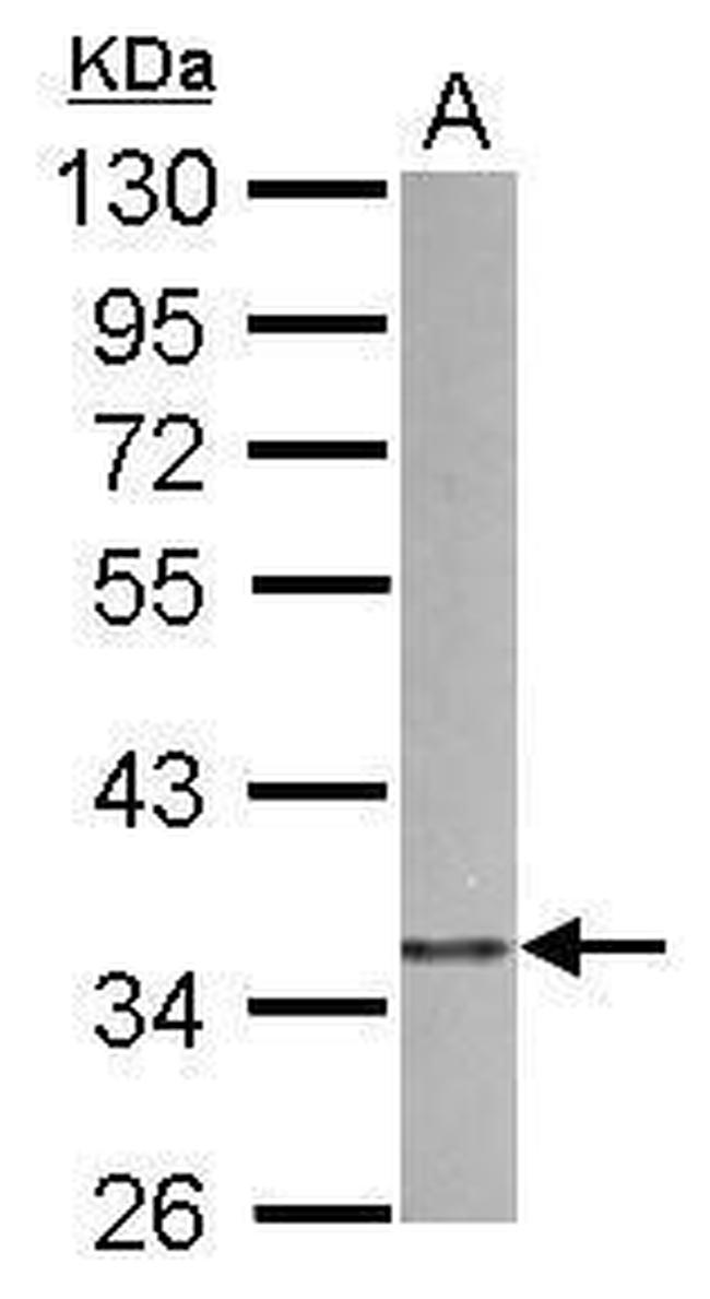 p41-ARCb Antibody in Western Blot (WB)