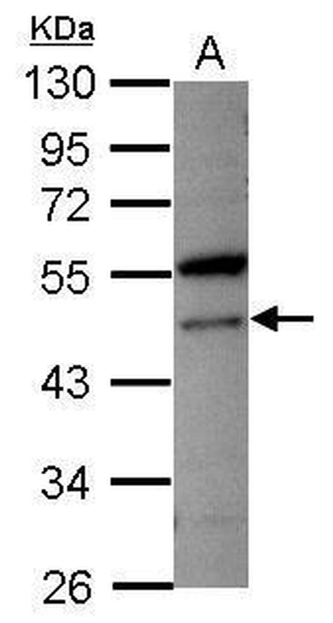 VPS4A Antibody in Western Blot (WB)