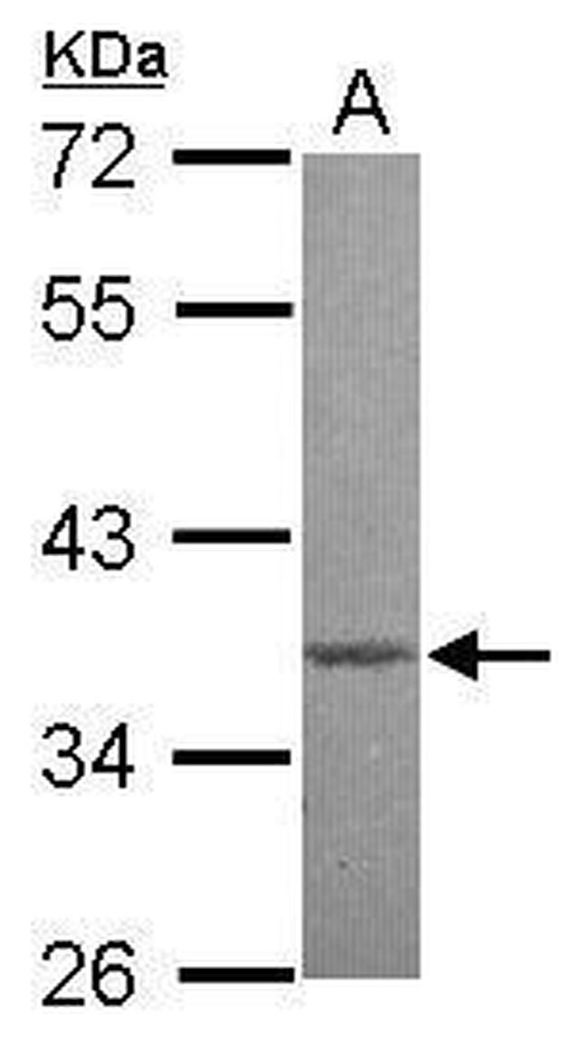 MBD3 Antibody in Western Blot (WB)