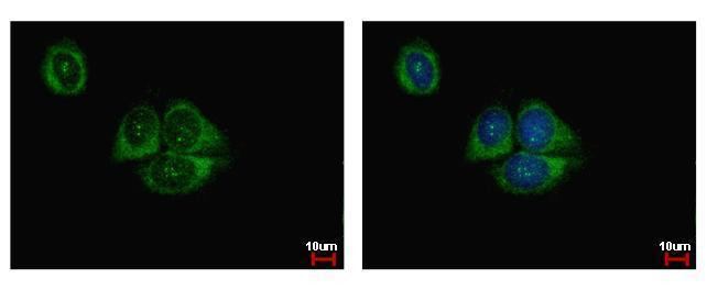 HIF1AN Antibody in Immunocytochemistry (ICC/IF)