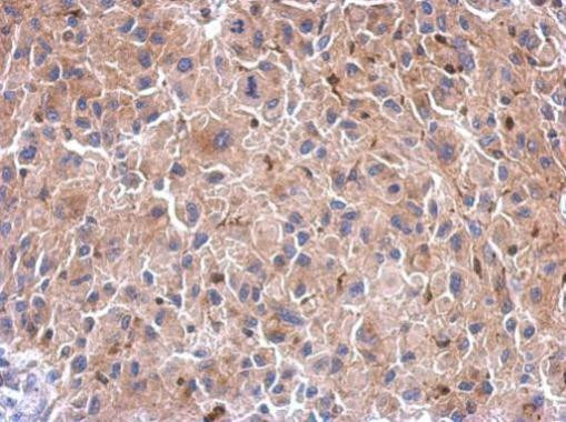 HIF1AN Antibody in Immunohistochemistry (Paraffin) (IHC (P))