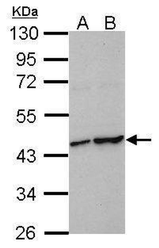 HIF1AN Antibody in Western Blot (WB)