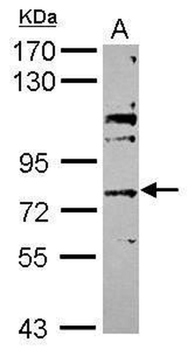 ABCG4 Antibody in Western Blot (WB)