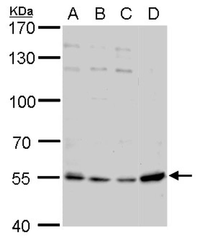 NAMPT Antibody in Western Blot (WB)