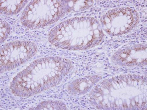 IL17C Antibody in Immunohistochemistry (Paraffin) (IHC (P))