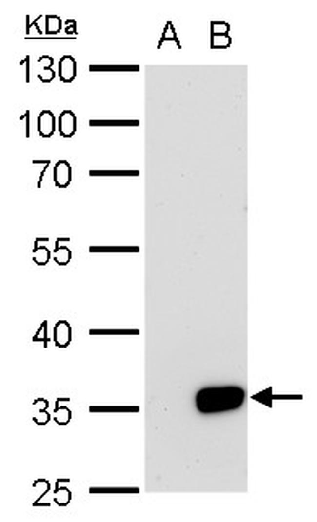 Galectin 8 Antibody in Western Blot (WB)