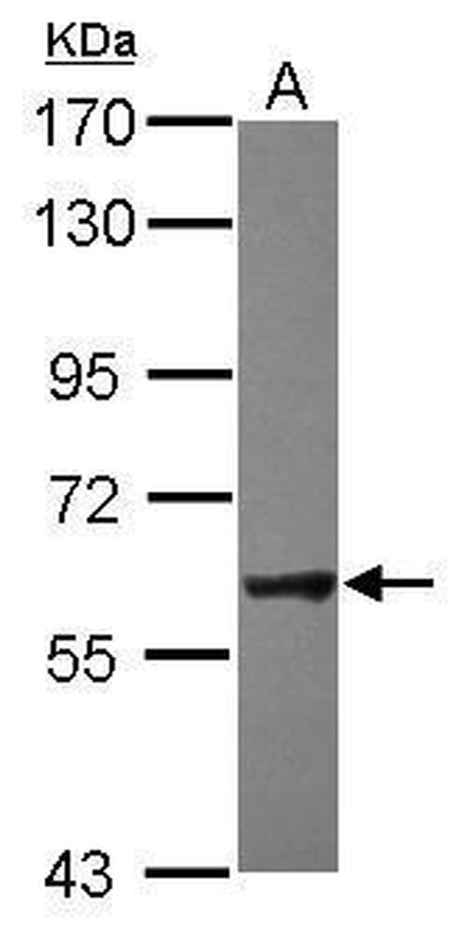 NXF2 Antibody in Western Blot (WB)