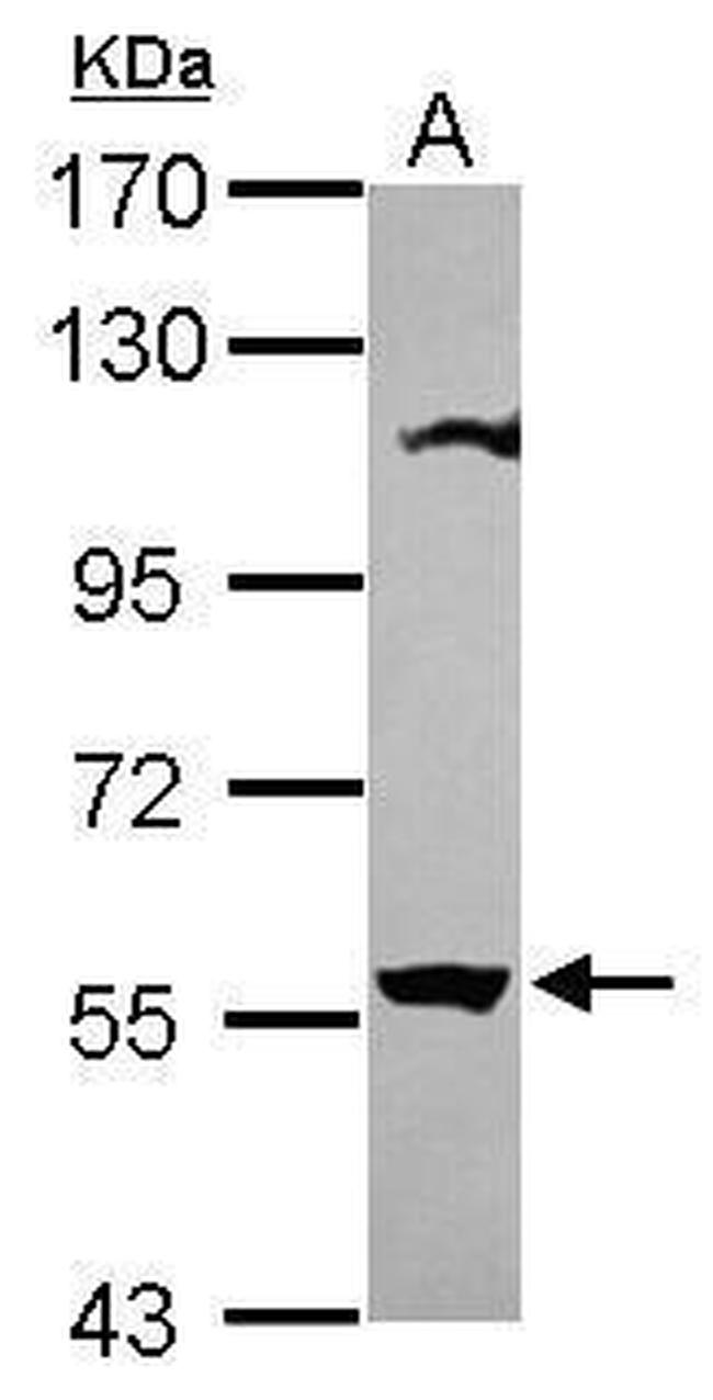 OASL Antibody in Western Blot (WB)