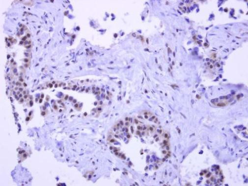 PYGO2 Antibody in Immunohistochemistry (Paraffin) (IHC (P))