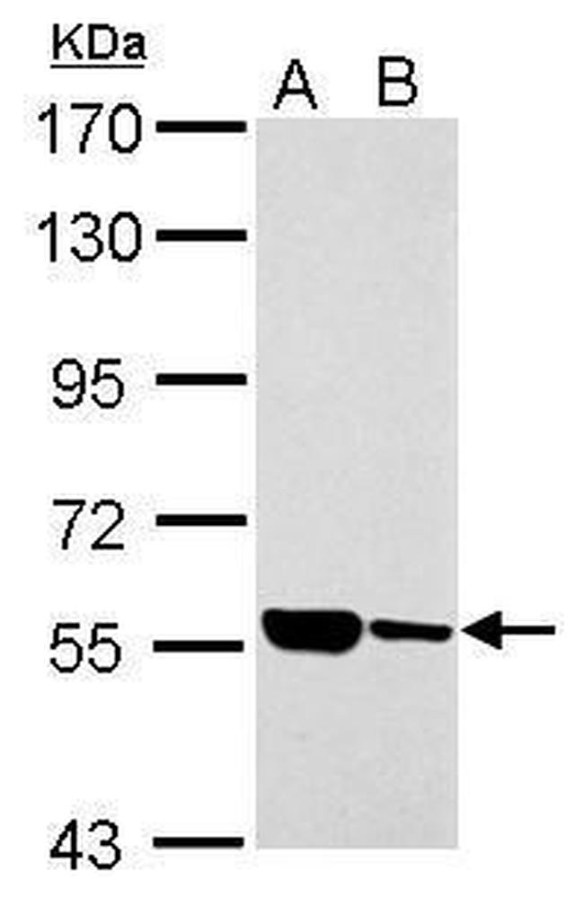 ILVBL Antibody in Western Blot (WB)