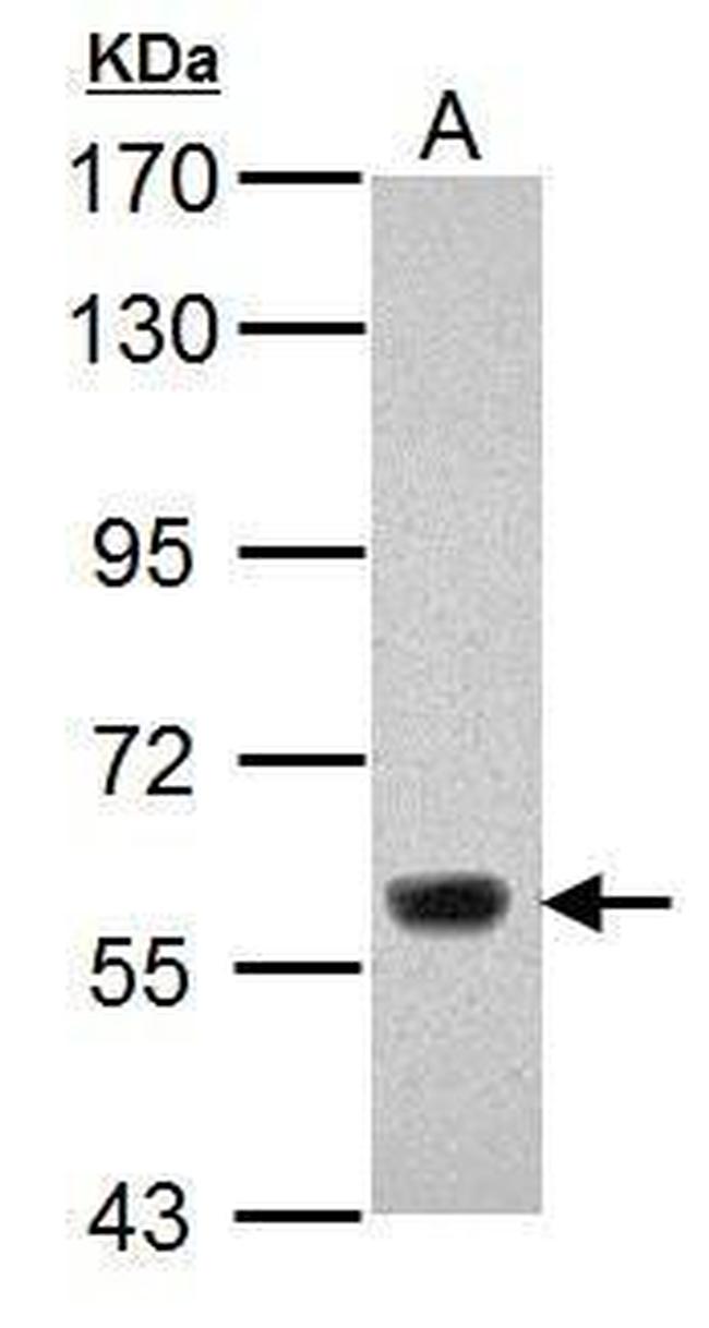 JMJD2D Antibody in Western Blot (WB)