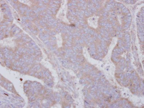 SMYD3 Antibody in Immunohistochemistry (Paraffin) (IHC (P))