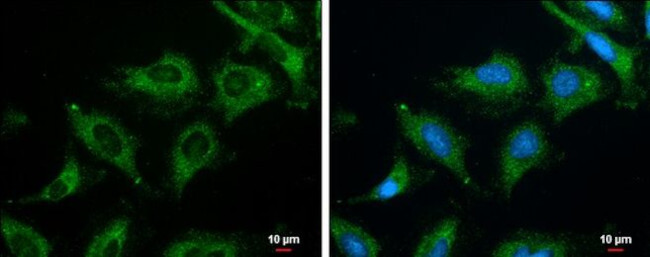 Phospho-ROCK2 (Ser1366) Antibody in Immunocytochemistry (ICC/IF)