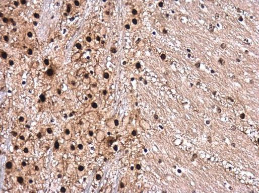 Phospho-ROCK2 (Ser1366) Antibody in Immunohistochemistry (Paraffin) (IHC (P))