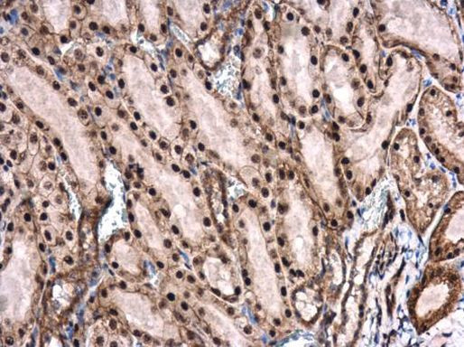 Phospho-ROCK2 (Ser1366) Antibody in Immunohistochemistry (Paraffin) (IHC (P))