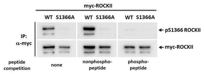 Phospho-ROCK2 (Ser1366) Antibody in Western Blot (WB)