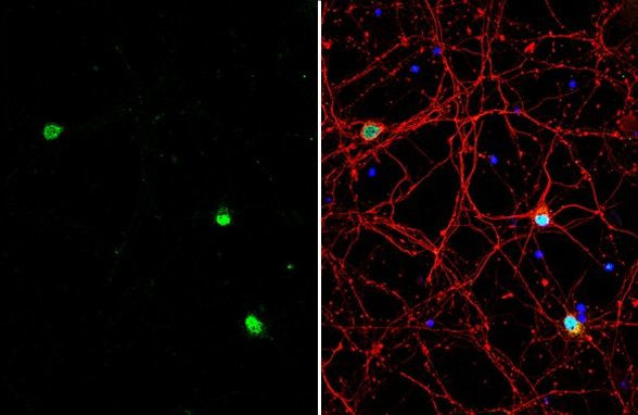 BAF53B Antibody in Immunocytochemistry (ICC/IF)