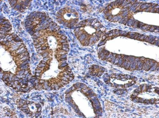 ALDH1A1 Antibody in Immunohistochemistry (Paraffin) (IHC (P))