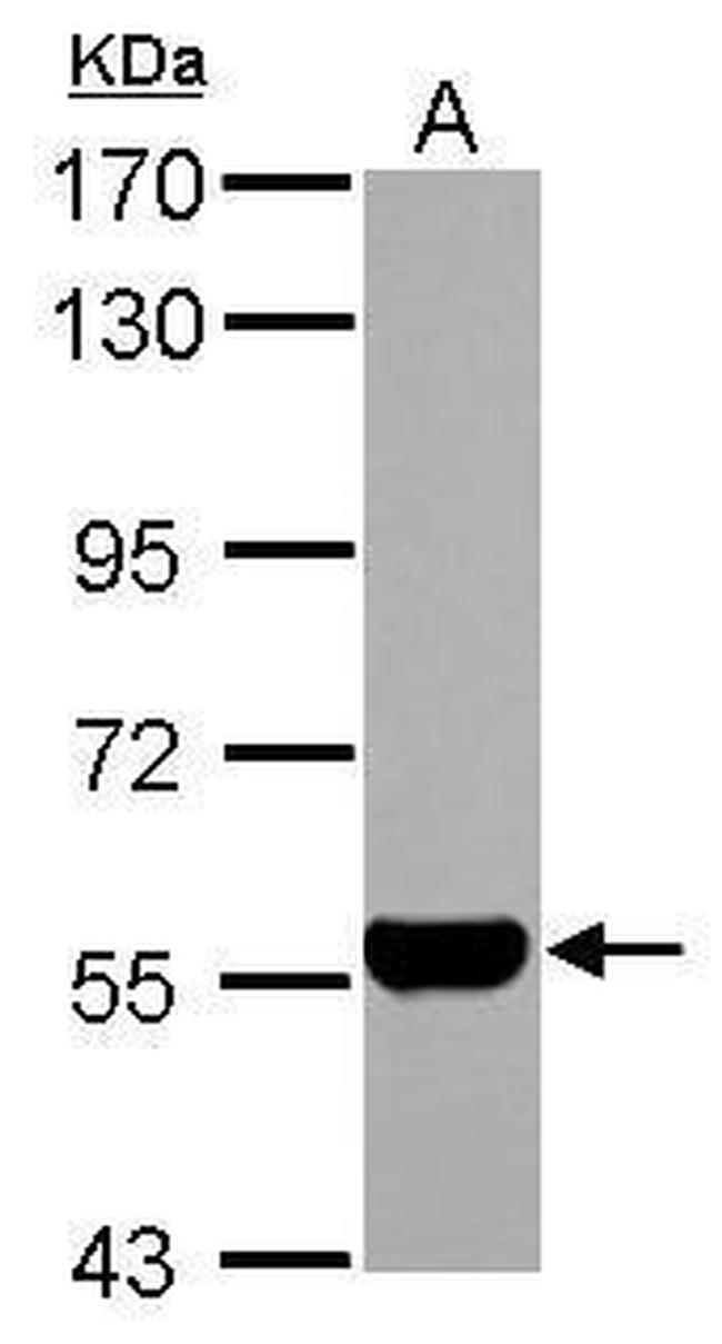 ALDH1A1 Antibody in Western Blot (WB)