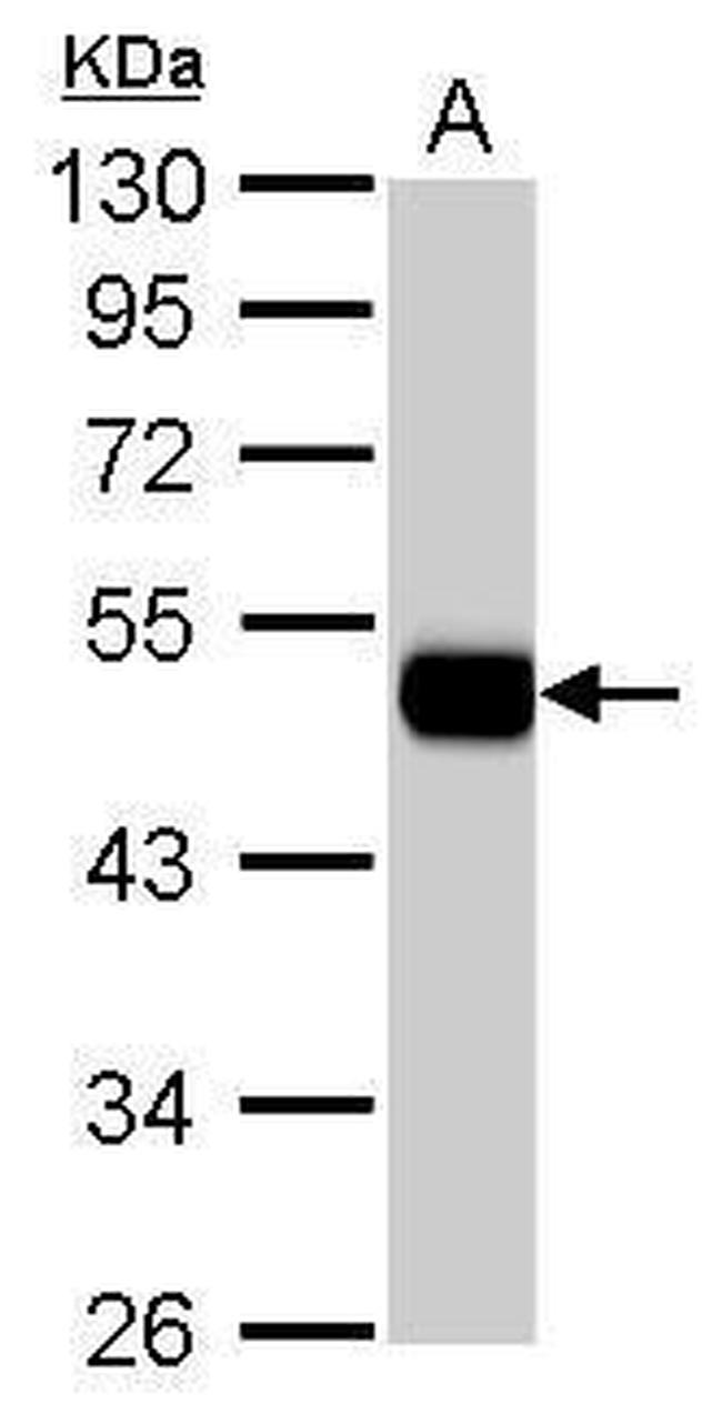 ALDH1A1 Antibody in Western Blot (WB)