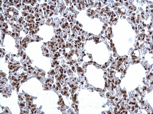 H3R17me2a Antibody in Immunohistochemistry (Paraffin) (IHC (P))