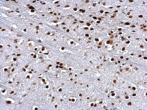 H3R17me2a Antibody in Immunohistochemistry (Paraffin) (IHC (P))