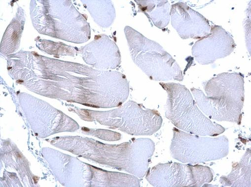 H3R17me2a Antibody in Immunohistochemistry (Paraffin) (IHC (P))